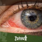 Yeux rouges et cannabis : Pourquoi et quoi faire 